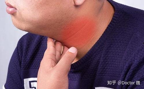 甲状腺吃角瓜吗,角瓜的营养与益处